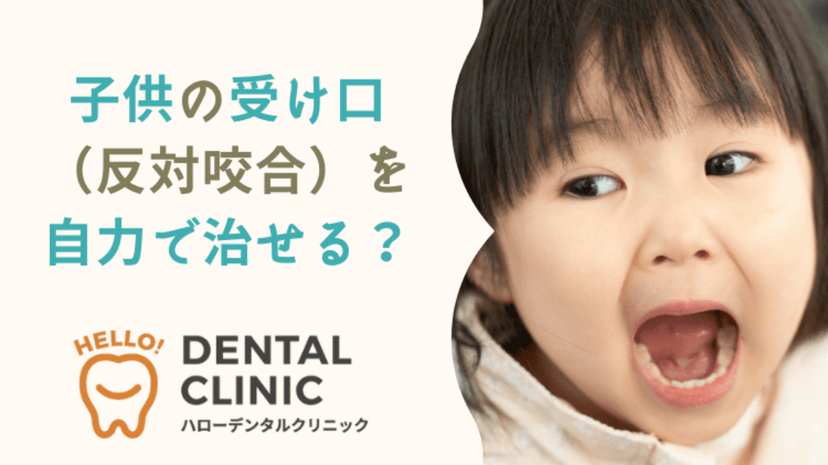 子供の受け口に child-orthodontic-socket-self-