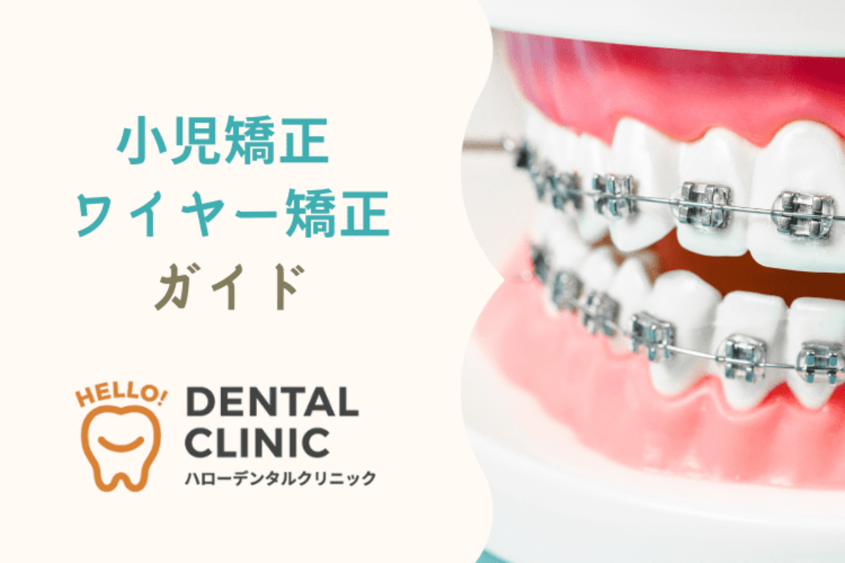 小児矯正 ワイヤー矯正ガイド】治療期間、費用、メリット＆デメリット