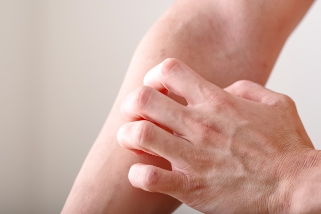 アレルギーで歯並びが悪くなってしまう原因と対策