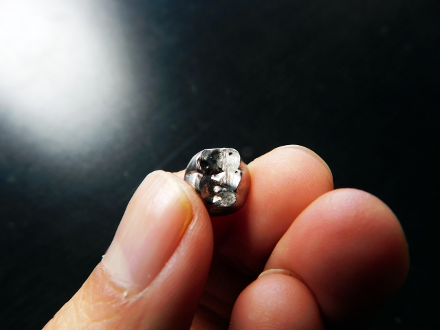 金属アレルギーでも歯列矯正はできる