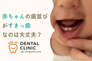 赤ちゃんの歯並びがすきっ歯なのは大丈夫？すきっ歯の理由や要注意な状態を解説